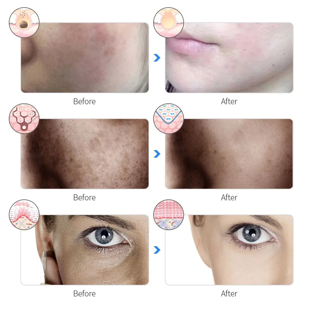 Máscara Facial LED Recarregável com 7 Cores, Terapia de Fotons LED, Máscara de Beleza para Rejuvenescimento da Pele, Levantamento Facial em Casa, Clareamento e Dispositivo de Beleza